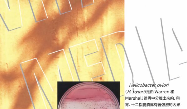 日本《極東》 H. pylori Selective Agar幽門螺旋桿菌寒天培養基